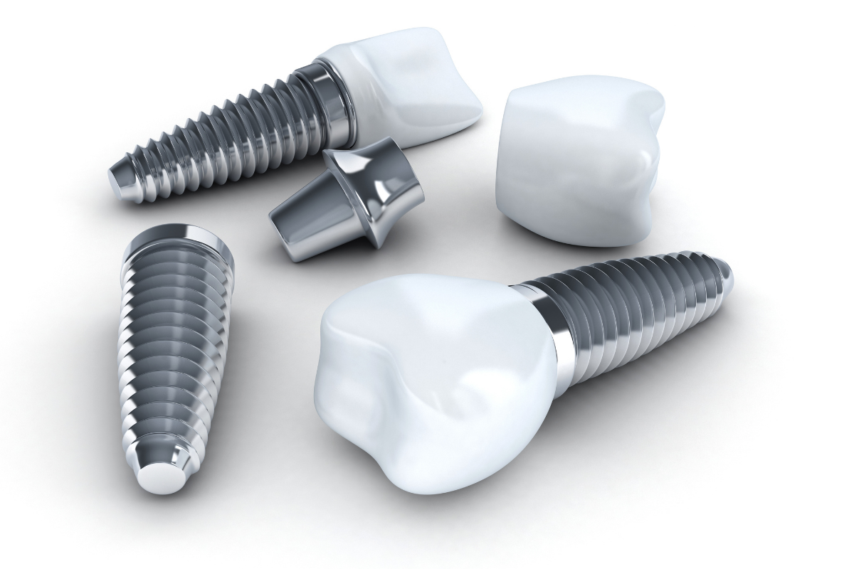 implant-tedavisi-sureci-ve-sonuclari-anlama (4)